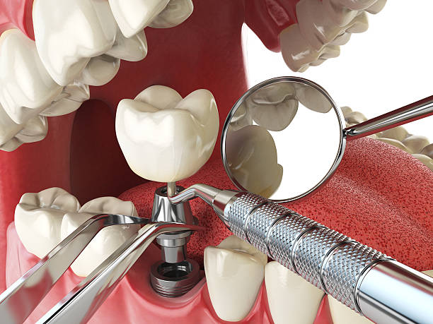 Best Emergency Denture Repair in Woodlake, CA